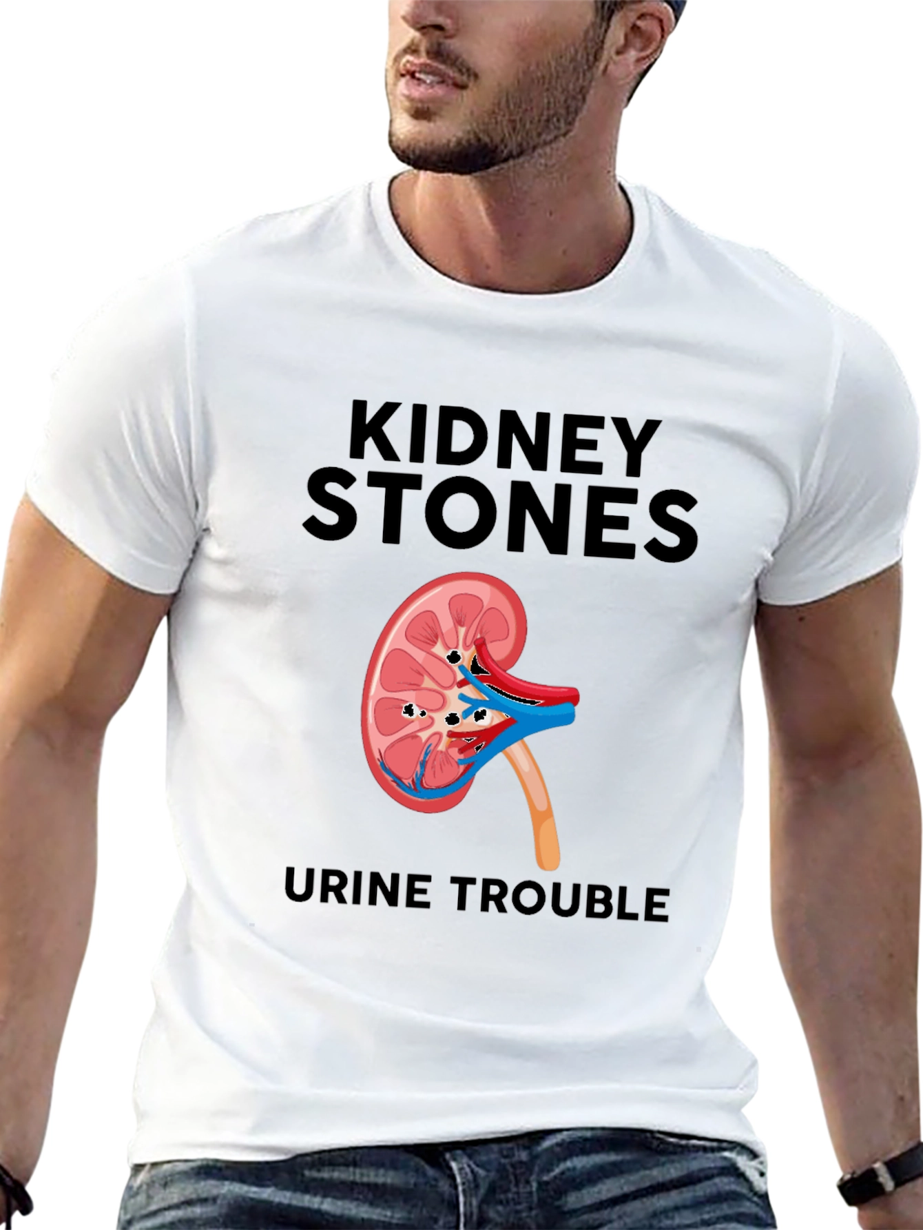 Kidney Stones T-Shirt - Funny Urological Tee