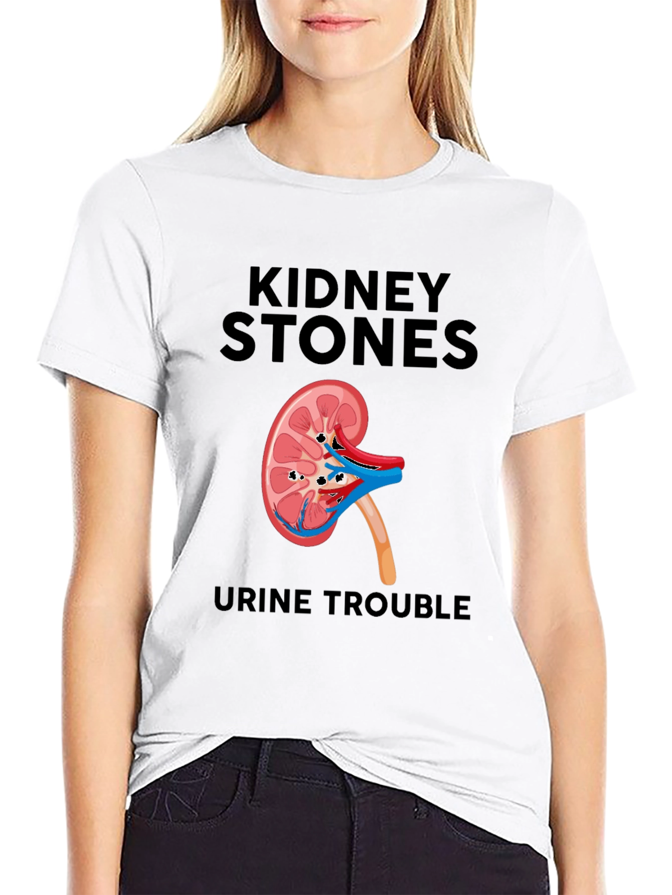 Kidney Stones T-Shirt - Funny Urological Tee