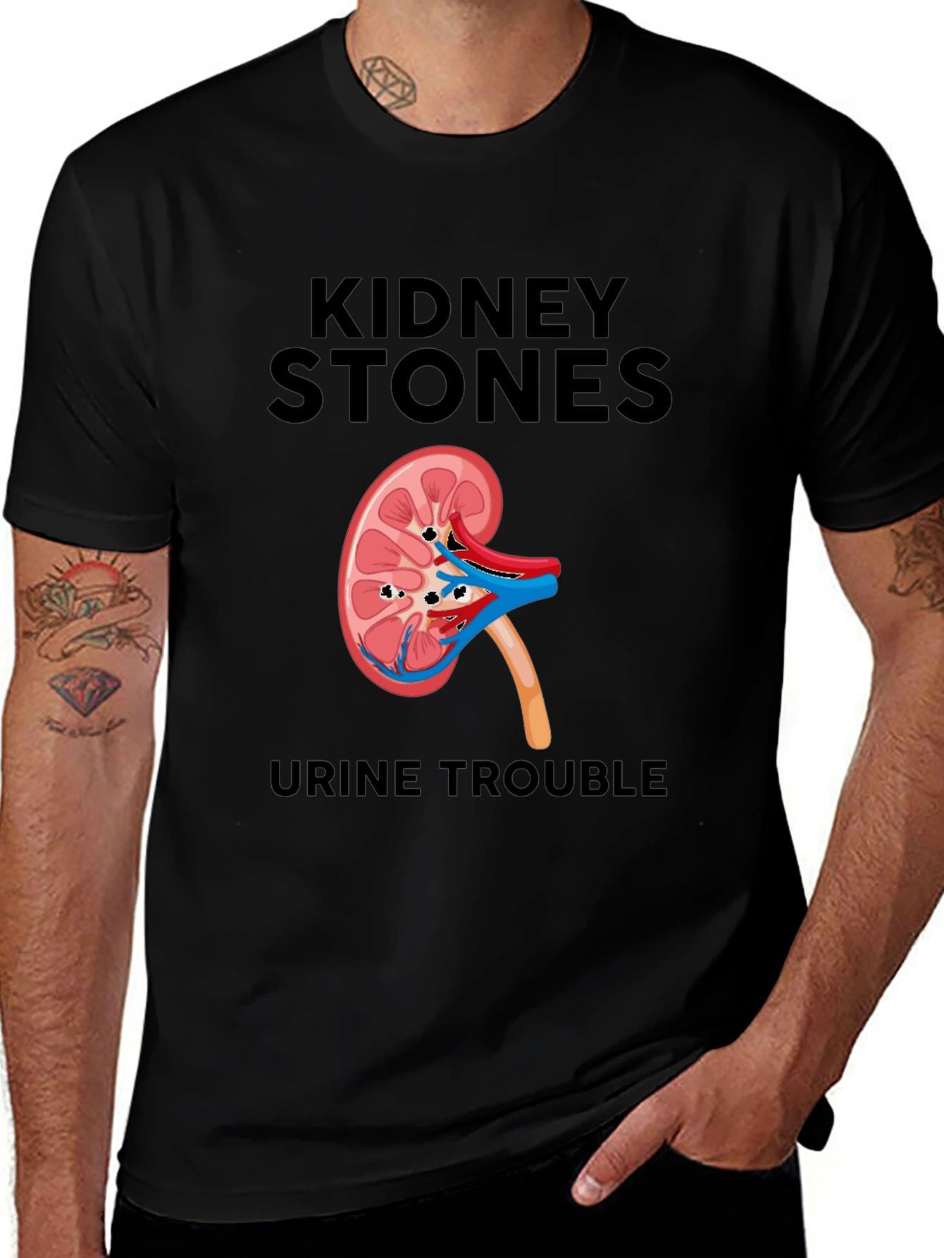 Kidney Stones T-Shirt - Funny Urological Tee