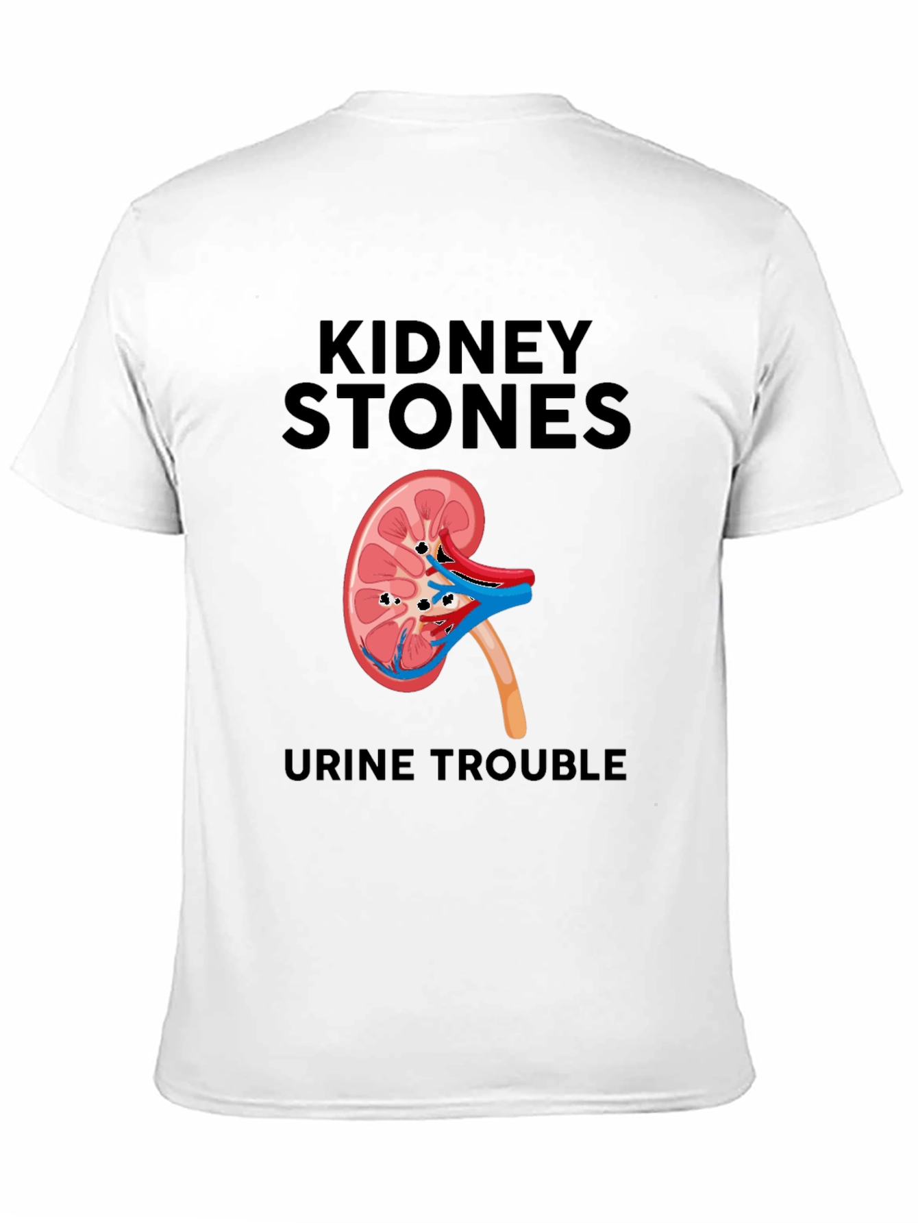 Kidney Stones T-Shirt - Funny Urological Tee
