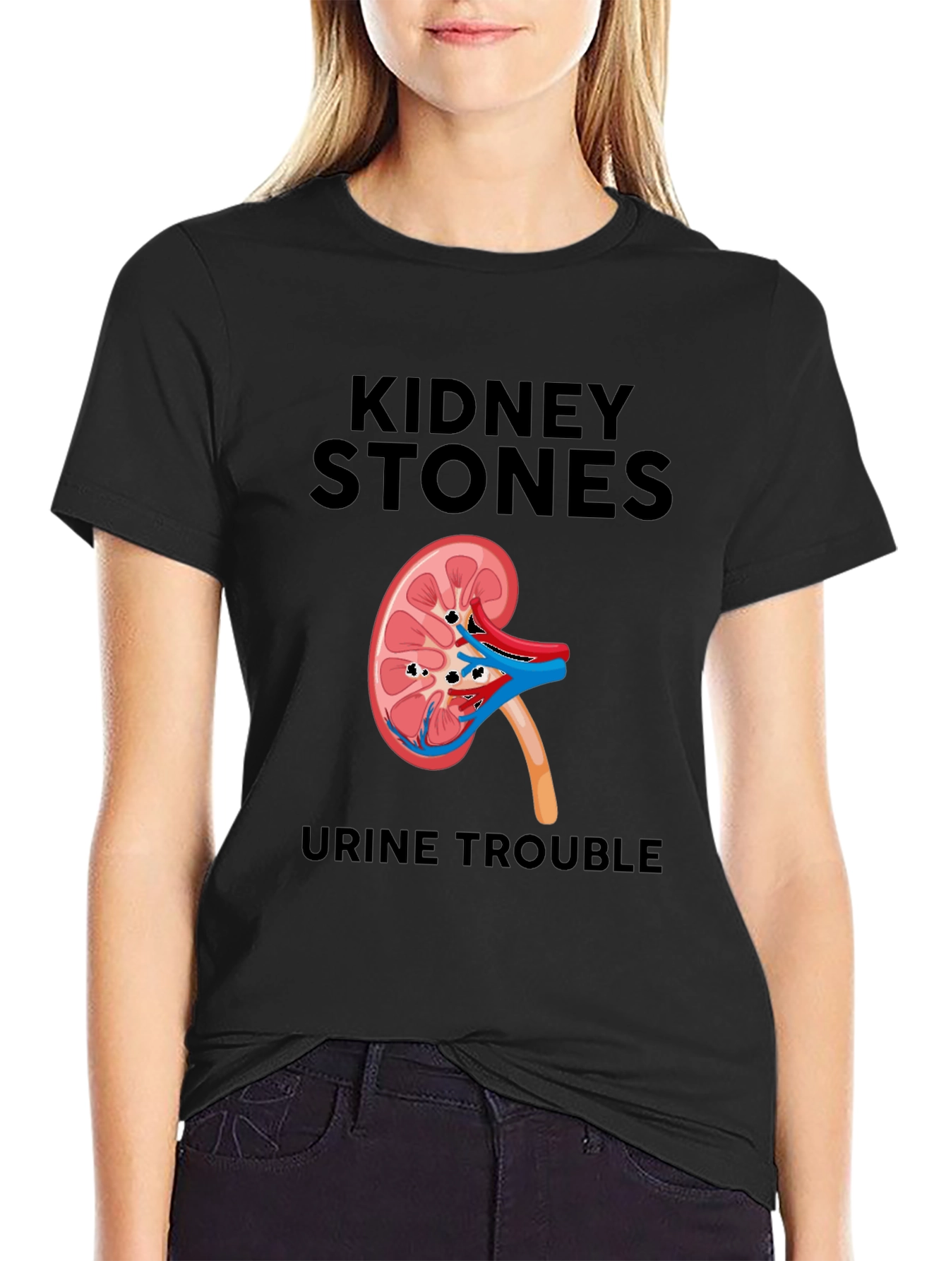 Kidney Stones T-Shirt - Funny Urological Tee