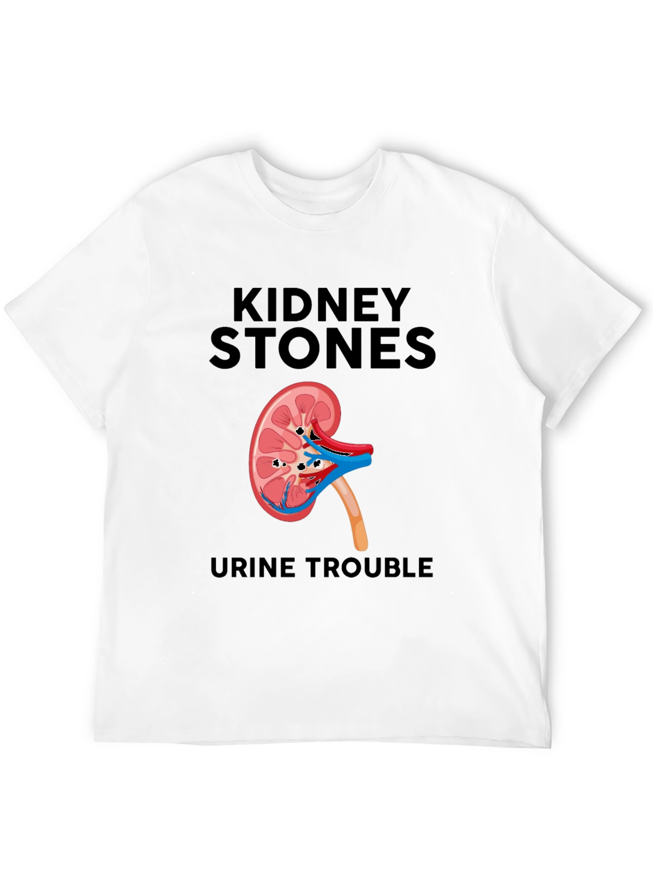 Kidney Stones T-Shirt - Funny Urological Tee
